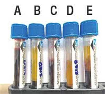 Clotted Blue Top Cbc  Blood Tube , Blood Sample Collection Vials supplier